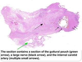 The section contains a section of the guttural pouch (green
arrow), a large nerve (black arrow), and the internal carotid
artery (multiple small arrows).
 