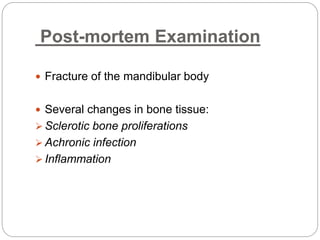 Post-mortem Examination
 Fracture of the mandibular body
 Several changes in bone tissue:
 Sclerotic bone proliferations
 Achronic infection
 Inflammation
 