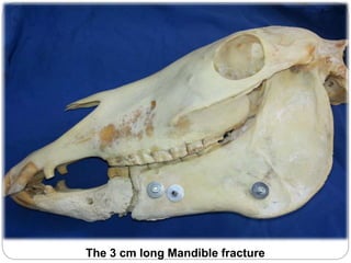 The 3 cm long Mandible fracture
 