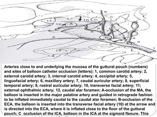 Arteries close to and underlying the mucosa of the guttural pouch (numbers)
and sites of balloon catheter occlusion (letters); 1, common carotid artery; 2,
external carotid artery; 3, internal carotid artery; 4, occipital artery; 5,
linguofacial artery; 6, maxillary artery; 7, caudal auricular artery; 8, superficial
temporal artery; 9, rostral auricular artery; 10, transverse facial artery; 11;
external ophthalmic artery; 12, caudal alar foramen; A-occlusion of the MA, the
balloon is inserted in the major palatine artery and guided in retrograde fashion
to be inflated immediately caudal to the caudal alar foramen; B-occlusion of the
ECA, the balloon is inserted into the transverse facial artery (10) at the arrow and
is directed into the ECA, where it is inflated close to the floor of the guttural
pouch; C occlusion of the ICA, balloon in the ICA at the sigmoid flexure. This
 