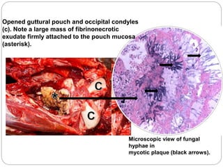 Microscopic view of fungal
hyphae in
mycotic plaque (black arrows).
Opened guttural pouch and occipital condyles
(c). Note a large mass of fibrinonecrotic
exudate firmly attached to the pouch mucosa
(asterisk).
 