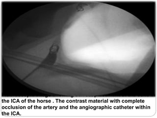 Fluoroscopic image showing correct placement of the coils in
the ICA of the horse . The contrast material with complete
occlusion of the artery and the angiographic catheter within
the ICA.
 
