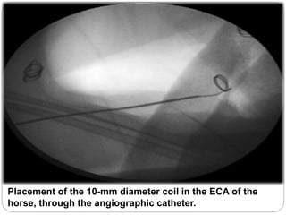 Placement of the 10-mm diameter coil in the ECA of the
horse, through the angiographic catheter.
 