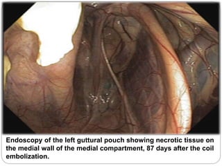 Endoscopy of the left guttural pouch showing necrotic tissue on
the medial wall of the medial compartment, 87 days after the coil
embolization.
 