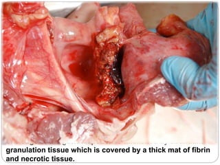 The edge of the guttural pouch is thickened by abundant
granulation tissue which is covered by a thick mat of fibrin
and necrotic tissue.
 