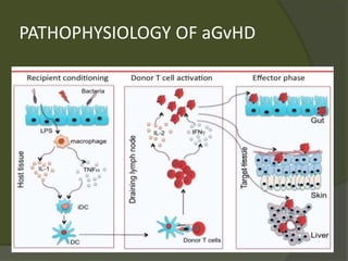 PATHOPHYSIOLOGY OF aGvHD
 