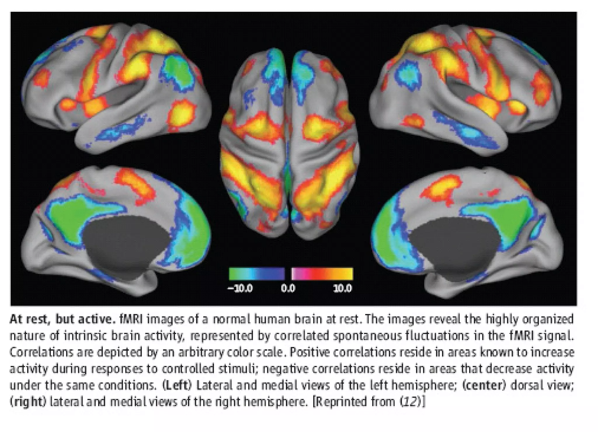 COHERENCE, SELF-SIMILARITY AND BRAIN ACTIVITY