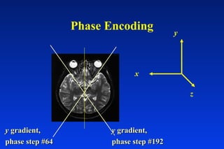 Phase Encoding
z
y
x
yy gradient,gradient,
phase step #192phase step #192
yy gradient,gradient,
phase step #64phase step #64
 