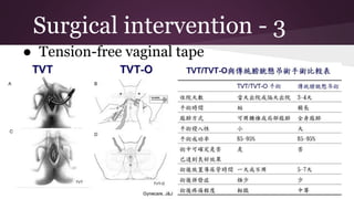 Stress urinary incontinence - case and brief | PPTX