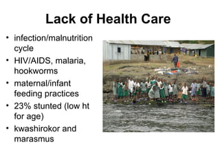 Lack of Health Care   infection/malnutrition cycle HIV/AIDS, malaria, hookworms maternal/infant feeding practices 23% stunted (low ht for age) kwashirokor and marasmus 