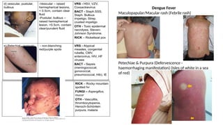 Comprehensive Pediatric Case Studies: Rash, Anaphylaxis, and Cerebral ...