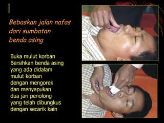 Buka mulut korban Bersihkan benda asing yang ada didalam  mulut korban dengan mengorek  dan menyapukan  dua jari penolong  yang telah dibungkus  dengan secarik kain Bebaskan jalan nafas dari sumbatan  benda asing 