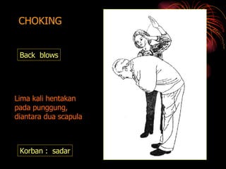 CHOKING Back  blows Korban :  sadar Lima kali hentakan pada punggung, diantara dua scapula 