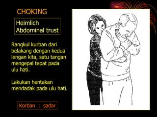 CHOKING Heimlich Abdominal trust Korban  :  sadar Rangkul kurban dari belakang dengan kedua lengan kita, satu tangan  mengepal tepat pada ulu hati. Lakukan hentakan  mendadak pada ulu hati. 