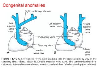 Congenital anomalies
 