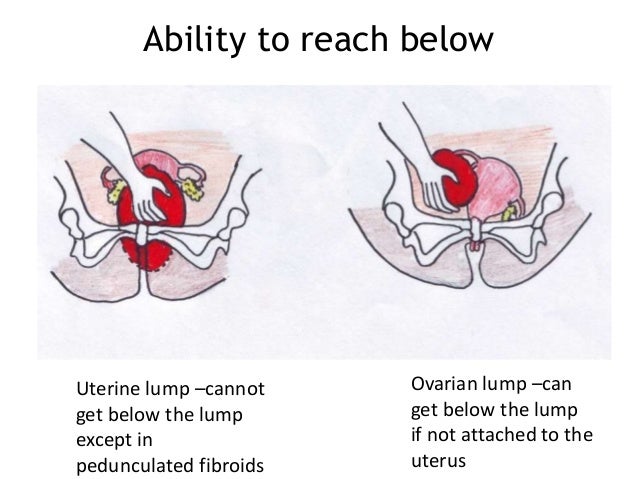 Gyaenocological Examination 2