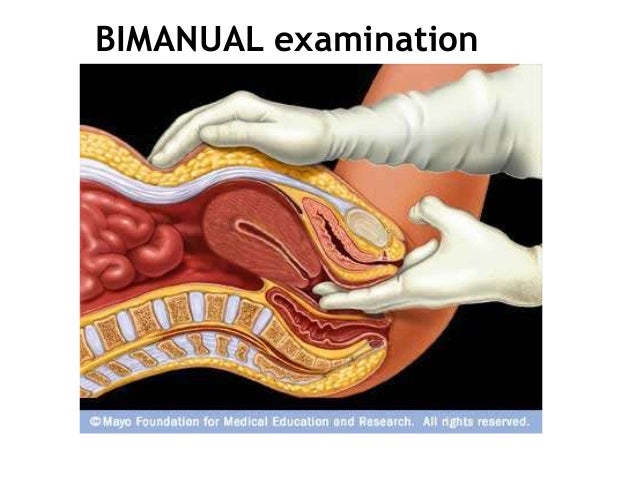 Gyaenocological Examination 2