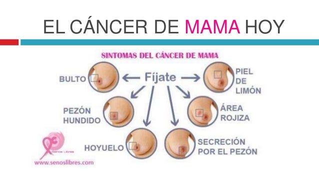 Cancer de mano sintomas