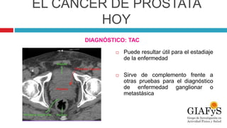 EL CÁNCER DE PRÓSTATA
HOY
DIAGNÓSTICO: TAC
 Puede resultar útil para el estadiaje
de la enfermedad
 Sirve de complemento frente a
otras pruebas para el diagnóstico
de enfermedad ganglionar o
metastásica
 