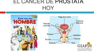 EL CÁNCER DE PRÓSTATA
HOY
 