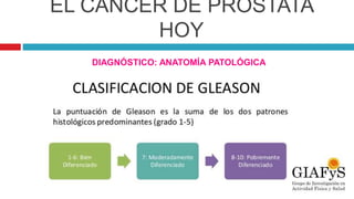 EL CÁNCER DE PRÓSTATA
HOY
DIAGNÓSTICO: ANATOMÍA PATOLÓGICA
 