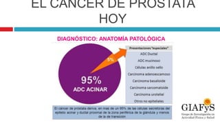 EL CÁNCER DE PRÓSTATA
HOY
DIAGNÓSTICO: ANATOMÍA PATOLÓGICA
 