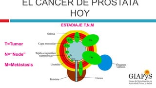 EL CÁNCER DE PRÓSTATA
HOY
ESTADIAJE T,N,M
T=Tumor
N=“Node”
M=Metástasis
 