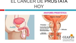 EL CÁNCER DE PRÓSTATA
HOY
ANATOMÍA PROSTÁTICA
 