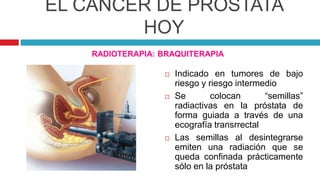 EL CÁNCER DE PRÓSTATA
HOY
RADIOTERAPIA: BRAQUITERAPIA
 Indicado en tumores de bajo
riesgo y riesgo intermedio
 Se colocan “semillas”
radiactivas en la próstata de
forma guiada a través de una
ecografía transrrectal
 Las semillas al desintegrarse
emiten una radiación que se
queda confinada prácticamente
sólo en la próstata
 