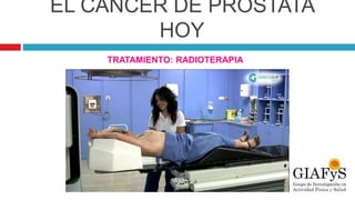 EL CÁNCER DE PRÓSTATA
HOY
TRATAMIENTO: RADIOTERAPIA
 
