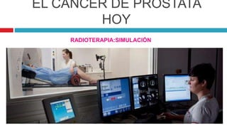 EL CÁNCER DE PRÓSTATA
HOY
RADIOTERAPIA:SIMULACIÓN
 