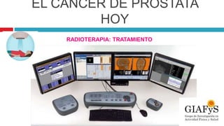 EL CÁNCER DE PRÓSTATA
HOY
RADIOTERAPIA: TRATAMIENTO
 