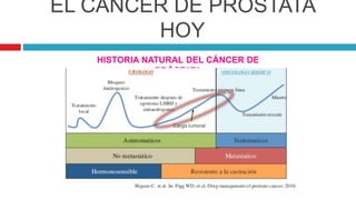 EL CÁNCER DE PRÓSTATA
HOY
HISTORIA NATURAL DEL CÁNCER DE
PRÓSTATA
 