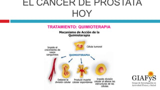EL CÁNCER DE PRÓSTATA
HOY
TRATAMIENTO: QUIMIOTERAPIA
 