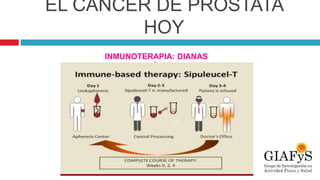 EL CÁNCER DE PRÓSTATA
HOY
INMUNOTERAPIA: DIANAS
TERAPÉUTICAS
 