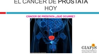 EL CÁNCER DE PRÓSTATA
HOY
CÁNCER DE PRÓSTATA ¿QUÉ OCURRE?
 
