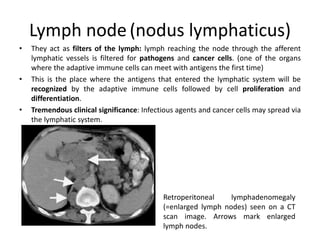 Lymph node (nodus lymphaticus)
• They act as filters of the lymph: lymph reaching the node through the afferent
lymphatic vessels is filtered for pathogens and cancer cells. (one of the organs
where the adaptive immune cells can meet with antigens the first time)
• This is the place where the antigens that entered the lymphatic system will be
recognized by the adaptive immune cells followed by cell proliferation and
differentiation.
• Tremendous clinical significance: Infectious agents and cancer cells may spread via
the lymphatic system.
Retroperitoneal lymphadenomegaly
(=enlarged lymph nodes) seen on a CT
scan image. Arrows mark enlarged
lymph nodes.
 