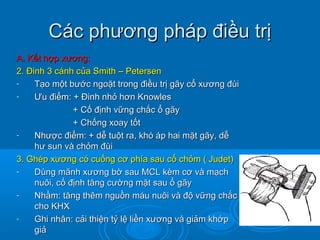 Các phương pháp điều trịCác phương pháp điều trị
A. Kết hợp xương:A. Kết hợp xương:
2. Đinh 3 cánh của Smith – Petersen2. Đinh 3 cánh của Smith – Petersen
- Tạo một bước ngoặt trong điều trị gãy cổ xương đùiTạo một bước ngoặt trong điều trị gãy cổ xương đùi
- ƯƯu điểm: + Đinh nhỏ hơn Knowlesu điểm: + Đinh nhỏ hơn Knowles
+ Cố định vững chắc ổ gãy+ Cố định vững chắc ổ gãy
+ Chống xoay tốt+ Chống xoay tốt
- Nhược điểm: + dễ tuột ra, khó áp hai mặt gãy, dễNhược điểm: + dễ tuột ra, khó áp hai mặt gãy, dễ
hư sun và chỏm đùihư sun và chỏm đùi
3. Ghép xương có cuống cơ phía sau cổ chỏm ( Judet)3. Ghép xương có cuống cơ phía sau cổ chỏm ( Judet)
- Dùng mãnh xương bờ sau MCL kèm cơ và mạchDùng mãnh xương bờ sau MCL kèm cơ và mạch
nuôi, cố định tăng cường mặt sau ổ gãynuôi, cố định tăng cường mặt sau ổ gãy
- Nhằm: tăng thêm nguồn máu nuôi và độ vững chắcNhằm: tăng thêm nguồn máu nuôi và độ vững chắc
cho KHXcho KHX
- Ghi nhân: cải thiện tỷ lệ liền xương và giảm khớpGhi nhân: cải thiện tỷ lệ liền xương và giảm khớp
giảgiả
 