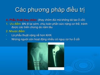 Các phương pháp điều trịCác phương pháp điều trị
A. Phẫu thuật thay chỏm:A. Phẫu thuật thay chỏm: (thay chỏm đùi mà không tái tạo ổ cối)(thay chỏm đùi mà không tái tạo ổ cối)
1.1. ƯƯu điểmu điểm: BN đi lại sớm, chịu toàn phần sức nặng cơ thể, tránh: BN đi lại sớm, chịu toàn phần sức nặng cơ thể, tránh
được các biến chứng do nằm lâuđược các biến chứng do nằm lâu
2. Nhược điểm:2. Nhược điểm:
- Là phẫu thuật nặng nề hơn KHXLà phẫu thuật nặng nề hơn KHX
- Những người còn hoạt động nhiều có nguy cơ hư ổ cốiNhững người còn hoạt động nhiều có nguy cơ hư ổ cối
 