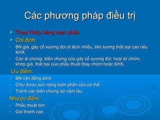 Các phương pháp điều trịCác phương pháp điều trị
 Thay khớp háng toàn phầnThay khớp háng toàn phần
 Chỉ định:Chỉ định:
- BN già, gãy cổ xương đùi di lệch nhiều, tiên lương thất bại cao nếuBN già, gãy cổ xương đùi di lệch nhiều, tiên lương thất bại cao nếu
KHXKHX
- Các di chứng, biến chứng của gãy cổ xương đùi: hoại tử chỏm,Các di chứng, biến chứng của gãy cổ xương đùi: hoại tử chỏm,
khớp giả, thất bại của phẫu thuật thay chỏm hoặc KHX.khớp giả, thất bại của phẫu thuật thay chỏm hoặc KHX.
Ưu điểm:Ưu điểm:
- BN vận động sớmBN vận động sớm
- Chịu được sức nặng toàn phần của cơ thểChịu được sức nặng toàn phần của cơ thể
- Tránh các biến chứng do nằm lâuTránh các biến chứng do nằm lâu
Nhược điểm:Nhược điểm:
- Phẫu thuật lớnPhẫu thuật lớn
- Giá thanh caoGiá thanh cao
 