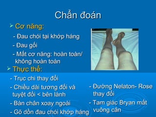 Chẩn đoánChẩn đoán
 Cơ năng:Cơ năng:
- Đau chói tại khớp háng- Đau chói tại khớp háng
- Đau gối- Đau gối
- Mất cơ năng: hoàn toàn/- Mất cơ năng: hoàn toàn/
không hoàn toànkhông hoàn toàn
- Đường Nelaton- Rose- Đường Nelaton- Rose
thay đổithay đổi
- Tam giác Bryan mất- Tam giác Bryan mất
vuông cânvuông cân
 Thực thể:Thực thể:
- Trục chi thay đổi- Trục chi thay đổi
- Chiều dài tương đối và- Chiều dài tương đối và
tuyệt đối < bên lànhtuyệt đối < bên lành
- Bàn chân xoay ngoài- Bàn chân xoay ngoài
- Gõ dồn đau chói khớp háng- Gõ dồn đau chói khớp háng
 