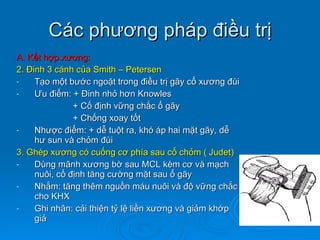 Các phương pháp điều trị A. Kết hợp xương: 2. Đinh 3 cánh của Smith – Petersen Tạo một bước ngoặt trong điều trị gãy cổ xương đùi Ư u điểm: + Đinh nhỏ hơn Knowles + Cố định vững chắc ổ gãy + Chống xoay tốt Nhược điểm: + dễ tuột ra, khó áp hai mặt gãy, dễ hư sun và chỏm đùi 3. Ghép xương có cuống cơ phía sau cổ chỏm ( Judet) Dùng mãnh xương bờ sau MCL kèm cơ và mạch nuôi, cố định tăng cường mặt sau ổ gãy Nhằm: tăng thêm nguồn máu nuôi và độ vững chắc cho KHX Ghi nhân: cải thiện tỷ lệ liền xương và giảm khớp giả 