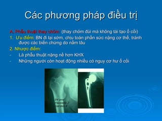 Các phương pháp điều trị A. Phẫu thuật thay chỏm:  (thay chỏm đùi mà không tái tạo ổ cối) 1.  Ư u điểm : BN đi lại sớm, chịu toàn phần sức nặng cơ thể, tránh được các biến chứng do nằm lâu 2. Nhược điểm: Là phẫu thuật nặng nề hơn KHX Những người còn hoạt động nhiều có nguy cơ hư ổ cối 
