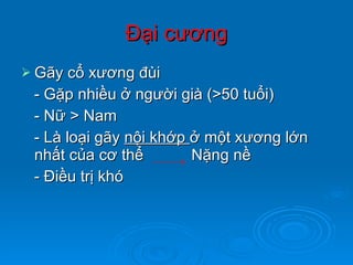 Đại cương Gãy cổ xương đùi - Gặp nhiều ở người già (>50 tuổi) - Nữ > Nam - Là loại gãy  nội khớp  ở một xương lớn nhất của cơ thể  Nặng nề - Điều trị khó 