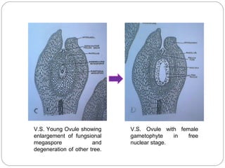 V.S. Young Ovule showing
enlargement of fungsional
megaspore and
degeneration of other tree.
V.S. Ovule with female
gametophyte in free
nuclear stage.
 
