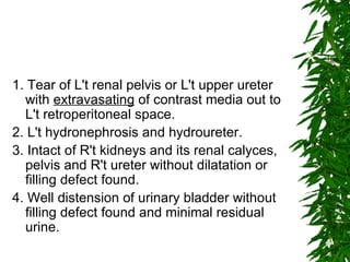 1. Tear of L't renal pelvis or L't upper ureter with  extravasating  of contrast media out to L't retroperitoneal space. 2. L't hydronephrosis and hydroureter. 3. Intact of R't kidneys and its renal calyces, pelvis and R't ureter without dilatation or filling defect found. 4. Well distension of urinary bladder without filling defect found and minimal residual urine.  