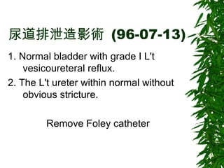 尿道排泄造影術   (96-07-13) 1. Normal bladder with grade I L't vesicoureteral reflux. 2. The L't ureter within normal without obvious stricture. Remove Foley catheter 
