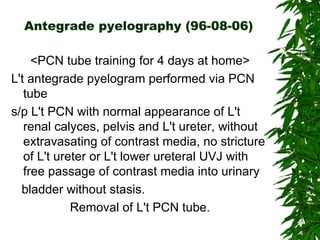 Antegrade pyelography (96-08-06) <PCN tube training for 4 days at home> L't antegrade pyelogram performed via PCN tube s/p L't PCN with normal appearance of L't renal calyces, pelvis and L't ureter, without extravasating of contrast media, no stricture of L't ureter or L't lower ureteral UVJ with free passage of contrast media into urinary bladder without stasis. Removal of L't PCN tube. 