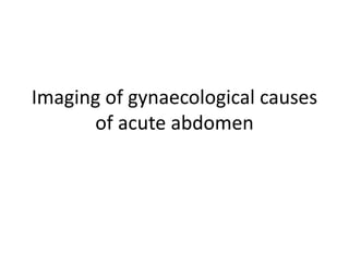 Imaging of gynaecological causes
of acute abdomen
 