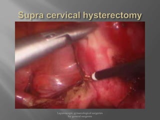 Laparoscopic gynaecological surgeries
for general surgeons
 
